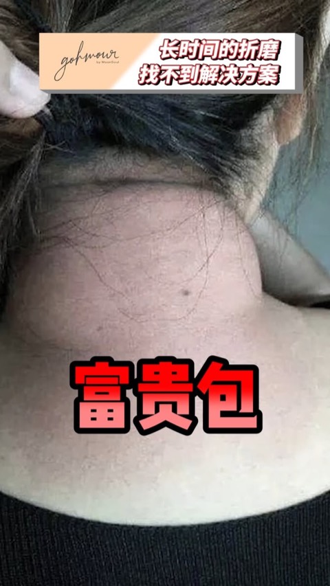 Gohmour by Moonsoul video ad thumbnail