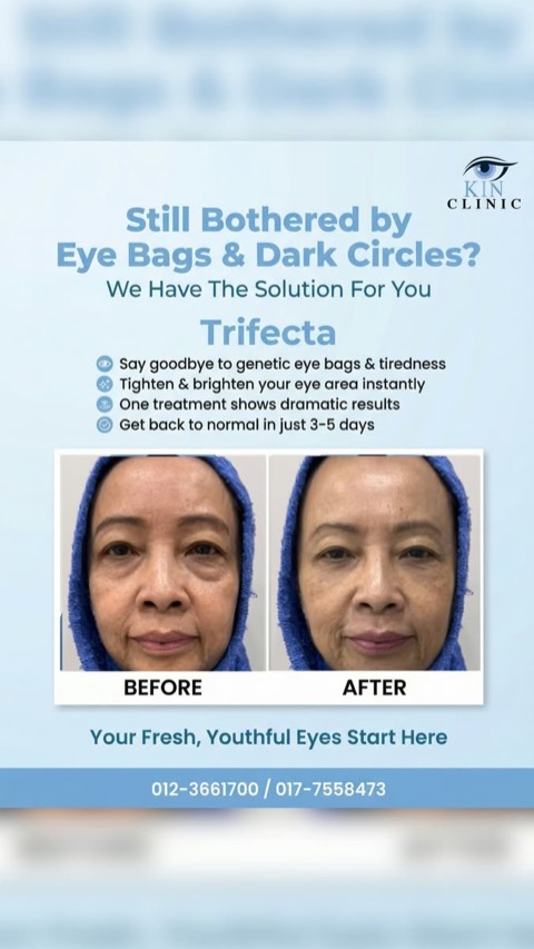Kin Clinic video ad thumbnail